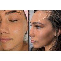 Deep Ultra Extraction Facial - Aesthetics by Faith, Brentwood