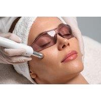 CO2 Laser Resurfacing - Restore Smooth, Youthful-Looking Skin Today