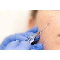 Tear Trough and Dermal Filler Facial Rejuvenation, Bare Skyn Aesthetics - Birmingham