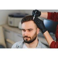 PRP Hair Restoration Session for Thicker, Healthier Hair, Including Consultation & Aftercare - London