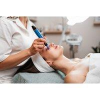 Microneedling Session at Aesthetic Beauty Works by Helen, Newcastle