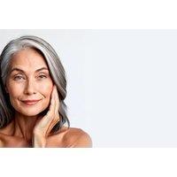 3ml Radiesse Dermal Filler, London La Beauty