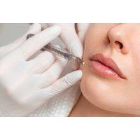 1ml Dermal Lip Filler Treatment - Wolverhampton