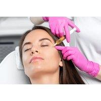 1, 2 or 3 PRP Therapy Sessions for Hair Restoration or Facial Rejuvenation - London