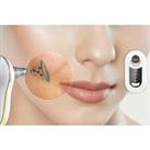 5-In-1 Blackhead Suction Tool - 3 Modes & 4 Colours! - Red